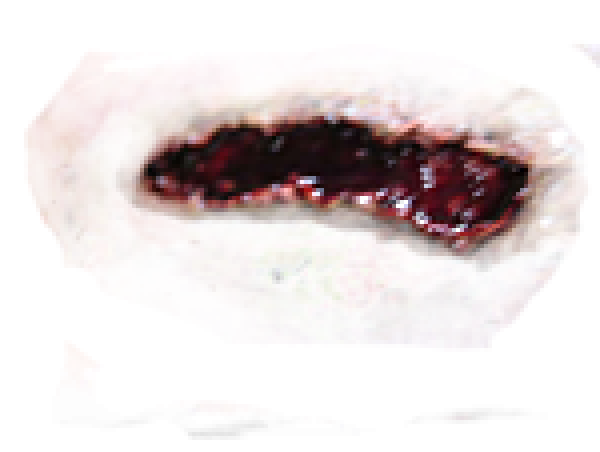 Wound PNG Free Download 2