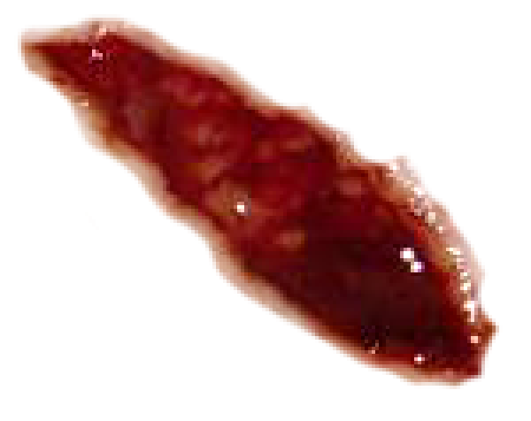 Wound PNG Free Download 3