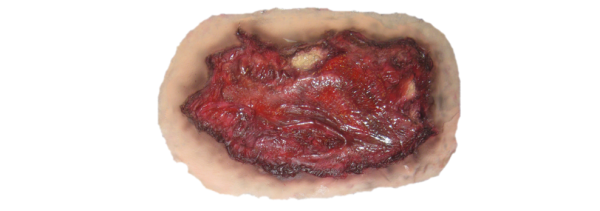 Wound PNG Free Download 7