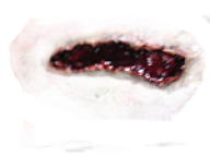 Wound PNG Free Download 2