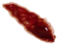 Wound PNG Free Download 3