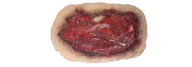 Wound PNG Free Download 7
